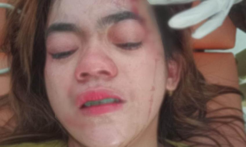 Bela Suami, Ibu Muda di Lebong Dianiaya